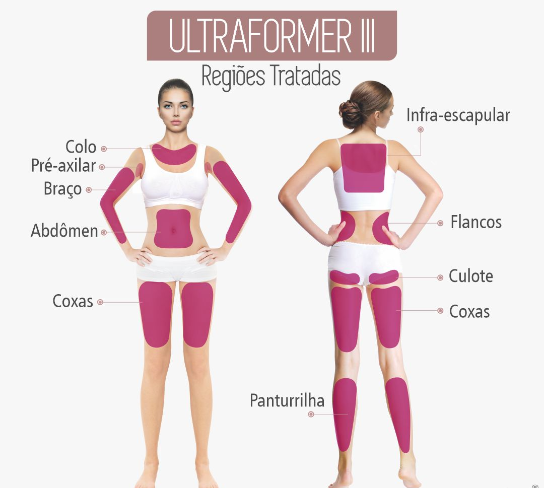 Ultraformer elimina a gordura da barriga?